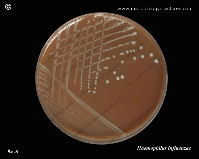 mucoid haemophilus influenzae group b